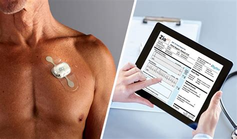 So far it has been prescribed to more than 150,000 patients. . Zio heart monitor cost